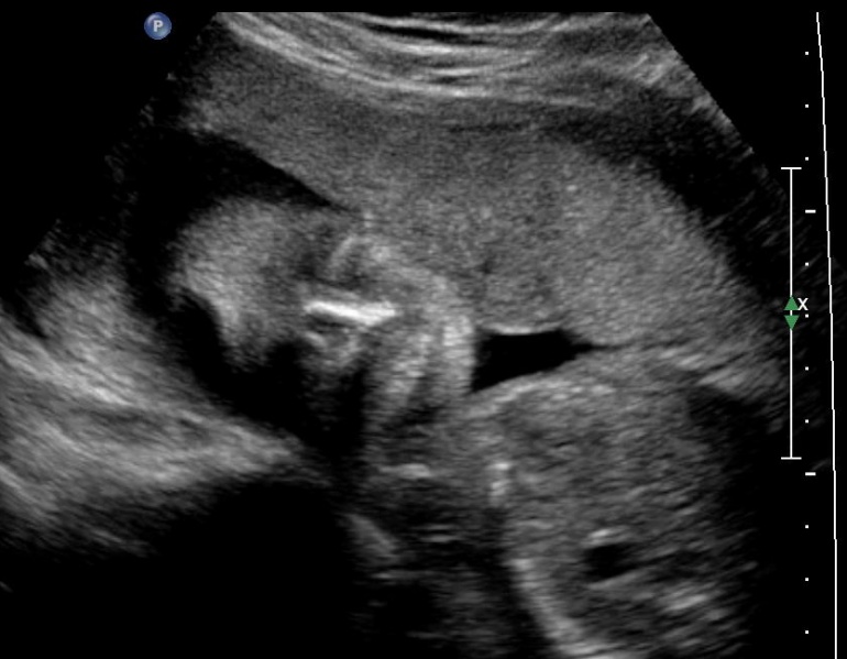 File:Ultrasound.jpg