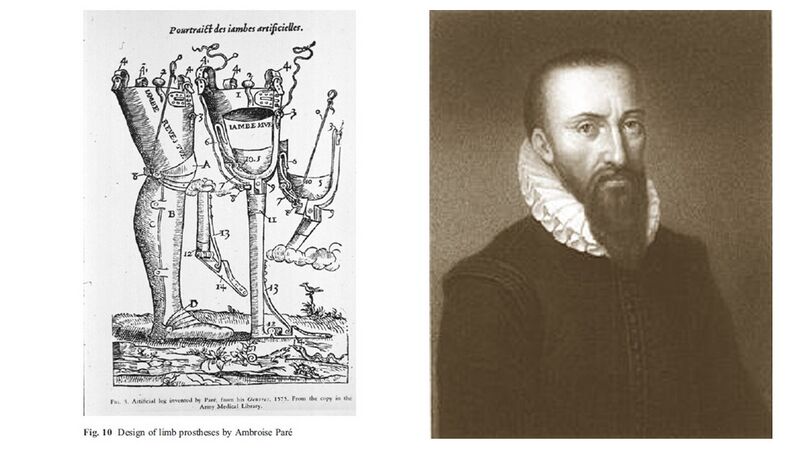 File:Ambroise Pare Collage Portrait and Prostheses.jpg