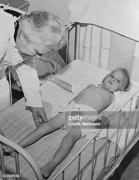 File:Gettyimages--polio-therapy-515169146-612x612.jpg